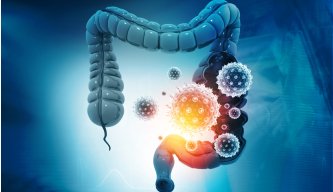Bowel (Colorectal) Cancer – Understanding and Tackling a Common GI Cancer