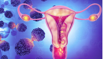 Cervical Cancer: The Cancer You Can Prevent, If You Act Early