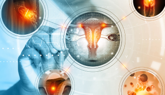 Surgery for Endometrial Cancer: The First Step Toward Healing