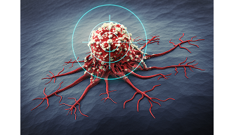 Theranostics in Nuclear Medicine: A New Era in Personalized Cancer Care