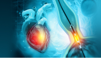Angiography: Seeing the Heart Before It’s Too Late