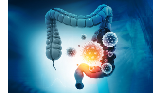 Bowel (Colorectal) Cancer – Understanding and Tackling a Common GI Cancer