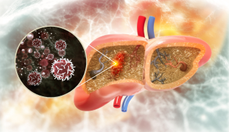 Gallbladder Cancer – Understanding a Rare but Aggressive Disease