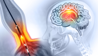 Everything You Need to Know About Brain Tumor Surgery: Types, Techniques & Recovery